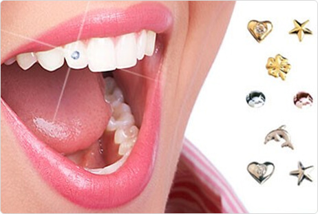 Teeth_Jewelry