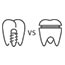 Fixed Bridge vs. Dental Implants