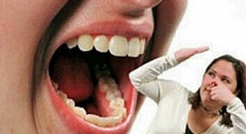 gum-Treatments