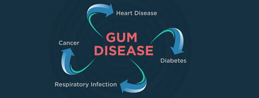 Gum Disease 