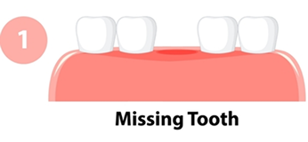 missing tooth