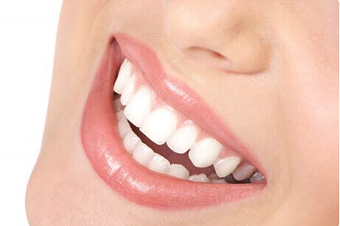 Veneers Fix Problems