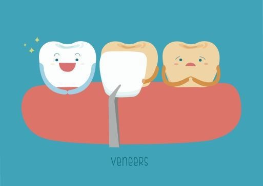 Dental Veneers Good Care