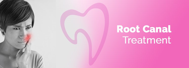rct advance dentistry