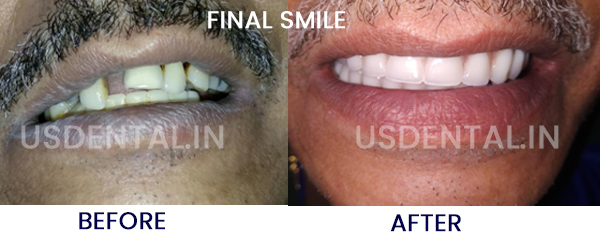 best treatment option