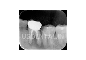 usdental