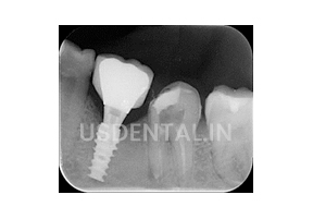 usdental