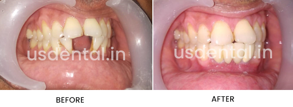 usdental