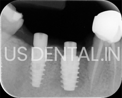 usdental