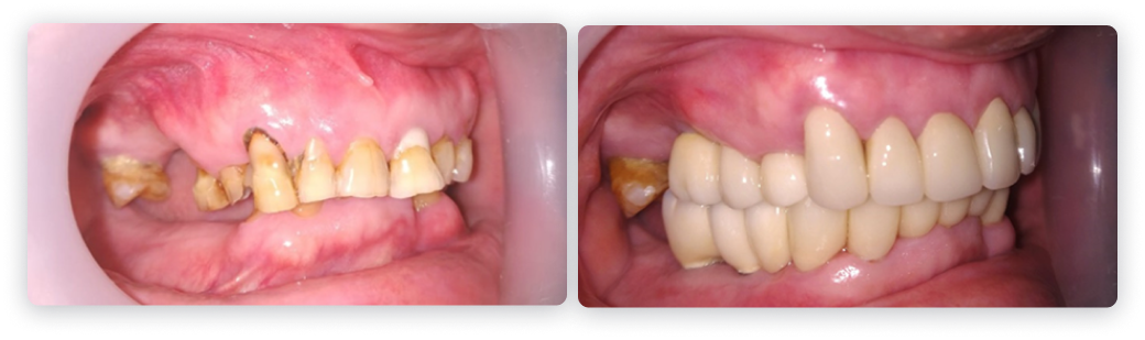 usdental