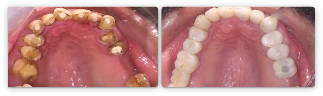 usdental