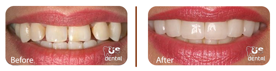 UsDental